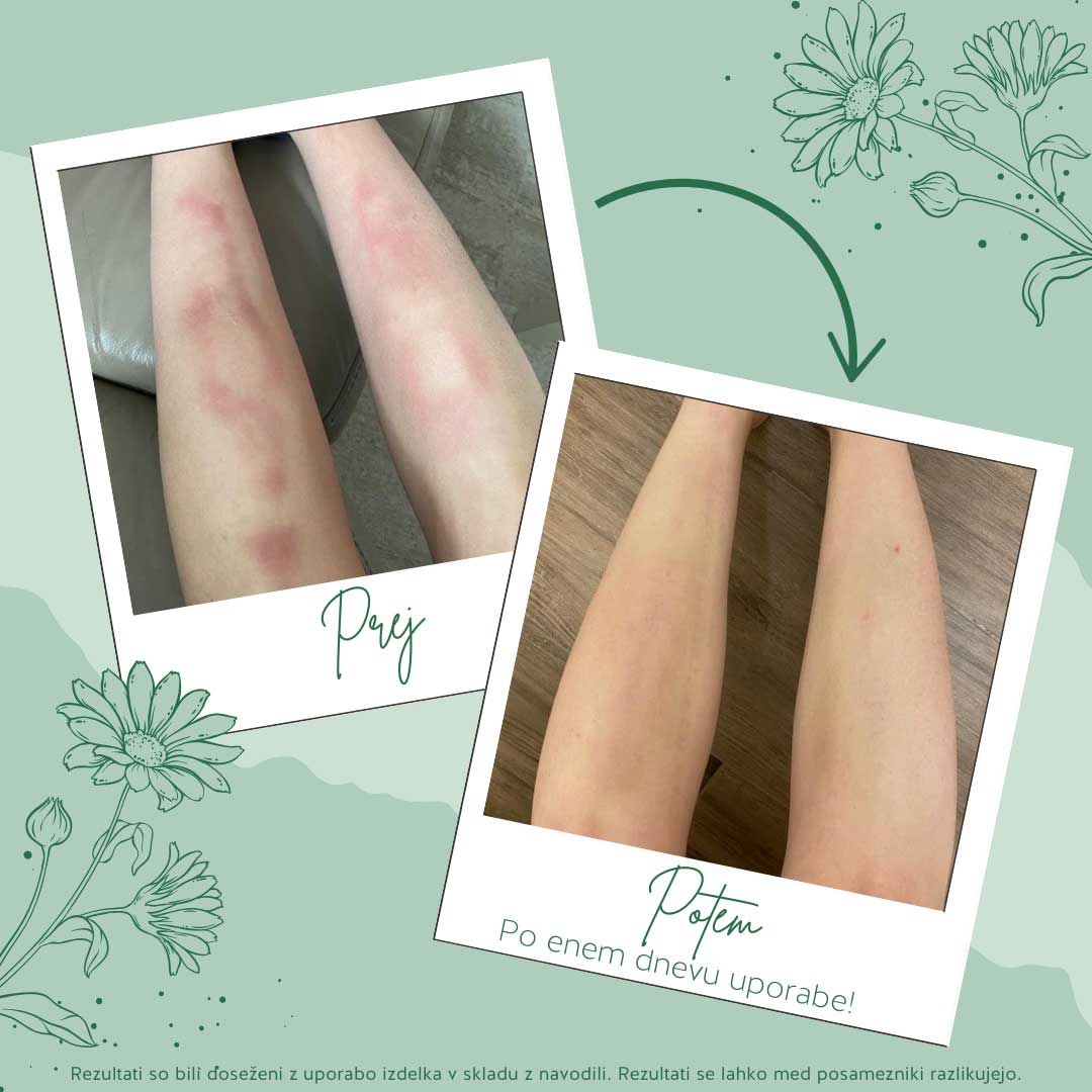 doc® nature‘s Arnika roll-on - slika 3